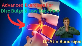 Advanced Exercises For Disc Bulge amp Low Back Pain [upl. by Ynoyrb]