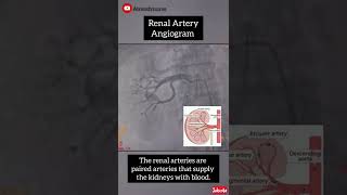 Renal Artery Angiogram atrendynurse543 cathlab renalartery angiogram [upl. by Esinwahs940]