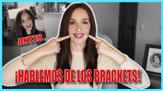 ORTODONCIA EN ADULTOS  Mi Experiencia Con BRACKETS PRECIOÂ¿Me Arrepiento [upl. by Colston]