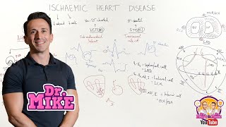 Ischemic Heart Disease Coronary Artery Disease [upl. by Idac]