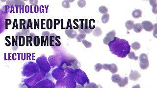 Paraneoplastic syndromes  Detailed explanation [upl. by Talanian]