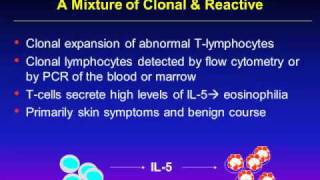 HES  Hypereosinophilic Syndrome Webinar Part 1 APFED [upl. by Sucram]