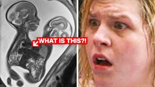 A mother does an ultrasound at 20 weeks pregnant then the doctor makes a shocking new discovery [upl. by Yeorgi636]