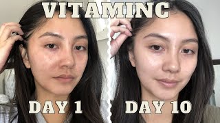 adding VITAMIN C serum to my skincare routine for 10 days  Vichy LiftActiv before amp after [upl. by Stultz]