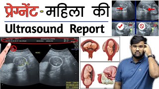 Pregnancy Ultrasound  Ultrasound Report  Medical  Doctor  MBBS  BHMS  BAMS  Nursing [upl. by Bealle]