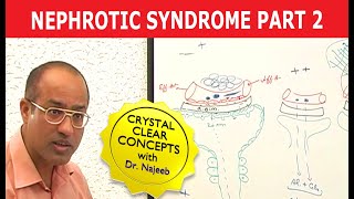 Nephrotic Syndrome  Part 2🩺 [upl. by Uke]