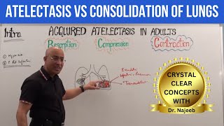 Atelectasis vs Consolidation of Lungs  Respiratory Pathology🫁 [upl. by Sydelle]