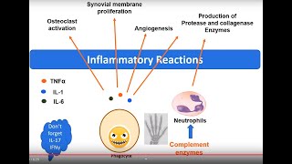 Rheumatoid Arthritis pathology in 5 minutes [upl. by Castro167]