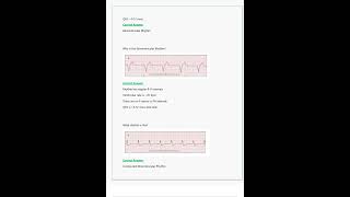 Relias Dysrhythmia Basic A Questions amp Answers All Correct amp Verified [upl. by Airamalegna]