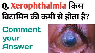 Xerophthalmia किस विटामिन की कमी से होता है [upl. by Inama]