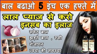 🔥 प्याज के रस से करो अपने बालो को लम्बे काले घने  Grow Hair Faster Naturally With Red Onion Oil [upl. by Dryden421]