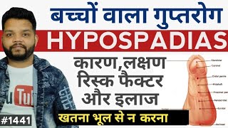 बच्चों मे होने वाला गुप्त रोग  Hypospadias Causes Symptoms amp Treatment [upl. by Nylahsoj]