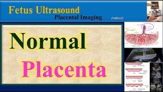 Fetus Ultrasound  Normal Placenta [upl. by Akirdnwahs876]