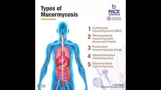 Black Fungus Infection  Mucormycosis Disease Causes Symptoms Diagnosis and Treatment [upl. by Ecinej415]