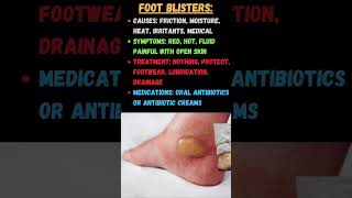 How To Prevent And Treat Foot amp Toe Blisters [upl. by Hpseoj]