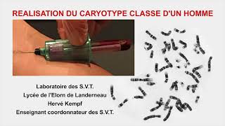 Caryotype humain classé protocole technique Cytogénétique [upl. by Gnov]