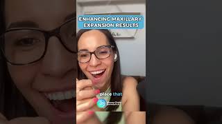 Enhancing Maxillary Expansion Results [upl. by Azaleah31]