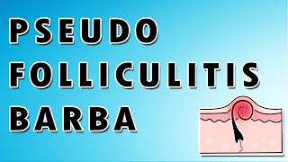 Pseudofolliculitis Barbae Symptoms Treatment and Causes [upl. by Keiryt]