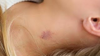 how to make a fake hickey on your neck with makeup fast [upl. by Eeroc]