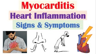 Myocarditis Heart Inflammation Signs amp Symptoms amp Why They Occur [upl. by Iredale52]