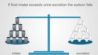 Hyponatremia Basics Understanding Water Intake amp Urine Output [upl. by Ameehsat]