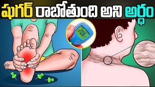 Pre Diabetes Symptoms Telugu  Early Diabetes Symptoms in Telugu  Diabetes Signs  iD Health 360 [upl. by Leen]