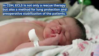 Pediatric ECMO Part II  Respiratory Indications [upl. by Herodias]