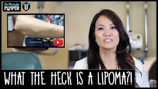 What are Lipomas anyway  Up on Dr Pimple Popper University [upl. by Dduj]