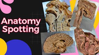 Anatomy spotting for Exam Question Answers [upl. by Eyar]