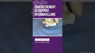 🦷 Tuto Prothèse 03  Lenregistrement du rapport intermaxillaire [upl. by Ellicott]