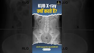 KUB Xray Test Purpose Preparation amp Procedure  radiographer xraytechnician peramedical [upl. by Ataliah]