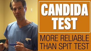 What Does Candida Look Like How to Know if You Have Candida [upl. by Meece]