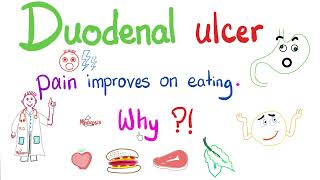 Pain of Duodenal Ulcer Improves on eating…Ever Wonder Why [upl. by Prentice]