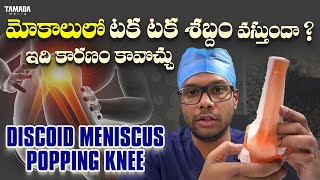 Knee pain amp Clicking  Discoid meniscus  Meniscal tear  Dr Ramprasad Kancherla [upl. by Anelak]