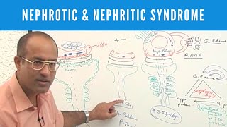 Nephrotic and Nephritic Syndrome  Causes Symptoms amp Treatment🩺 [upl. by Ruthven]