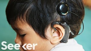 How Do Cochlear Implants Work [upl. by Clarise210]