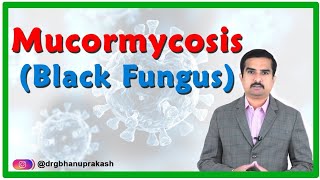 Mucormycosis  Black fungus disease in Covid 19 Causes Signs amp Symptoms Diagnosis and Treatment [upl. by Alad]