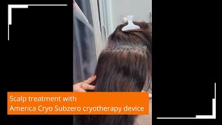 Subzero localized cryotherapy soothes the scalp after implantation of hair plugs [upl. by Haiacim]