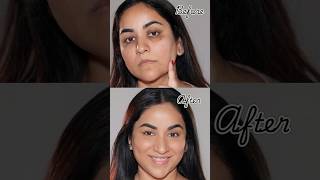 NO Foundation amp Concealer How to Cover Dark Circles Spots amp Scars [upl. by Tanhya]