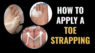 How Do I Do Toe Strapping Dislocated and Fractured Toe [upl. by Tomkins]