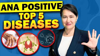 Top 5 Diseases with A Positive ANA Antinuclear Antibodies Test [upl. by Minetta]