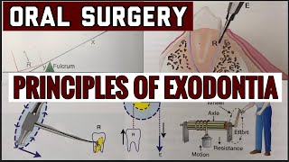 PRINCIPLES OF EXODONTIA II TOOTH EXTRACTION II ORAL SURGERY II imp [upl. by Jagir]