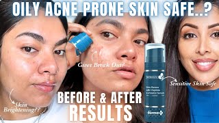 How Derma Co ABC Peptide Exfoliator Serum Works on Oily Acne Prone Skin Dr V Skin Renew Review [upl. by Ekle860]