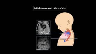 Fetal Echocardiography Protocol and Technique [upl. by Bruni]