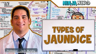 Gastrointestinal  Types of Jaundice [upl. by Leviram]