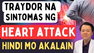 Traydor na Sintomas ng Heart Attack  By Doc Willie Ong Internist amp Cardiologist [upl. by Sixele]