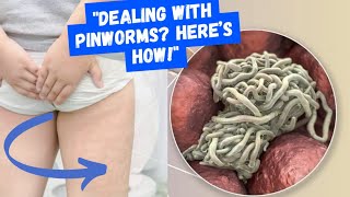 Pinworms Diagnosis Treatment and Prevention Tips [upl. by Hcirdla]