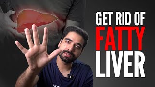 5 Foods To Avoid If You Have Fatty Liver [upl. by Aipmylo220]