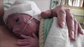 Barnaby Tiny Miracle Amazing story of a premature baby born at 27 weeks UK [upl. by Quintin]