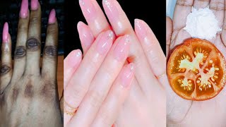 Hand whitening secret home remedies  Hand whitening cream  Manicure at home [upl. by Oiramd]